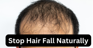 Stop hair fall